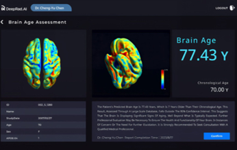 Brain